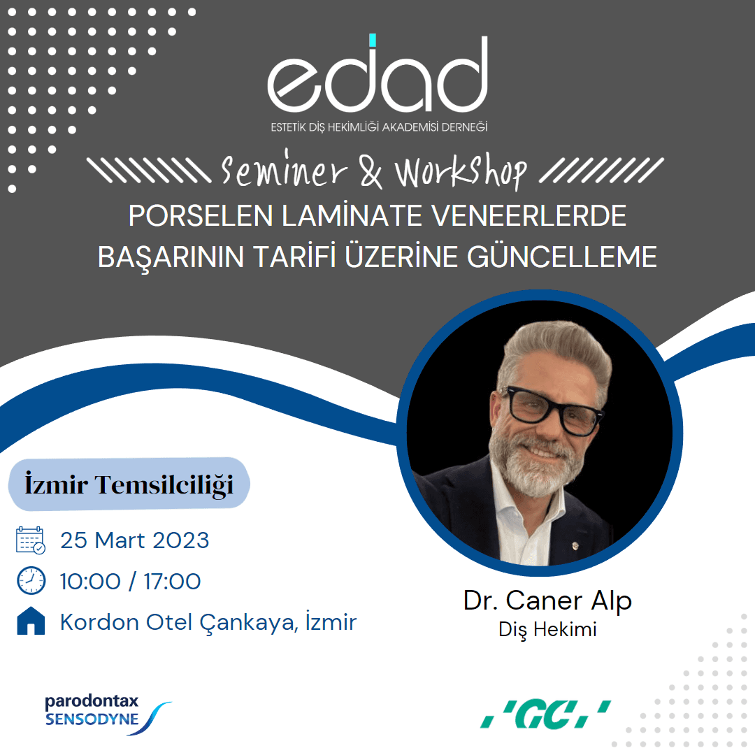 Porselen Laminate Veneerlerde Başarının Tarifi Üzerine Güncelleme