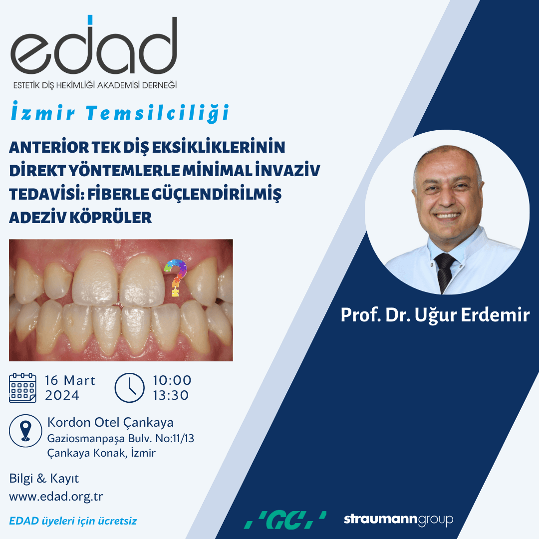 İzmir Seminer & Workshop. Anterior Tek Diş Eksikliklerinin Direkt Yöntemlerle Minimal İnvaziv Tedavisi: Fiberle Güçlendirilmiş Adeziv Köprüler
